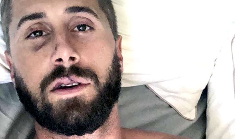 SAFETY ALERT! Gay Adult Film Actor Wesley Woods Says He Was Gay Bashed ...